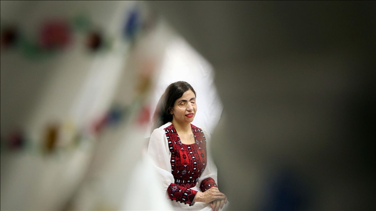 İranlı modacı asit saldırısına uğrayan kadınları manken yaptı