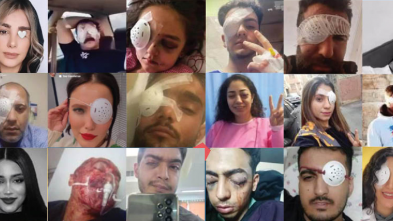 ‘İran’daki protestolarda 22 kişi gözünü kaybetti’