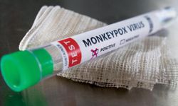 Sağlık Bakanlığı'ndan maymun çiçeği virüsü rehberi: Çiğ et uyarısı!