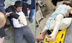 Polis müdahalesi sonucu yaralanan HDP’li vekilin ayağı alçıya alındı