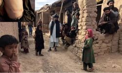Afganistan'da anne-baba olmak: Aç çocuklar uyuşturucuyla uyutuluyor, kız çocuklarının böbrekleri satılıyor