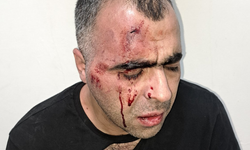 Saldırıya uğrayan Aygül, Tatvan Belediyesi'nde usulsüzlük iddialarını gündeme getirmişti