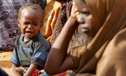 Güney Afrika'da bu yıl 600'den fazla çocuk yetersiz beslenme nedeniyle öldü