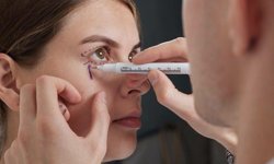 Elit Klinik Göz Kapağı Ameliyatı Neden Tercih Ediliyor?
