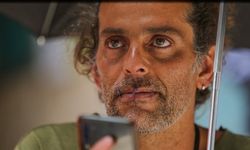 Kolombiyalı sanatçı önce ağzını dikti sonra açlık grevine başladı