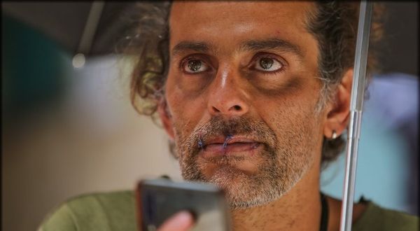 Kolombiyalı sanatçı önce ağzını dikti sonra açlık grevine başladı