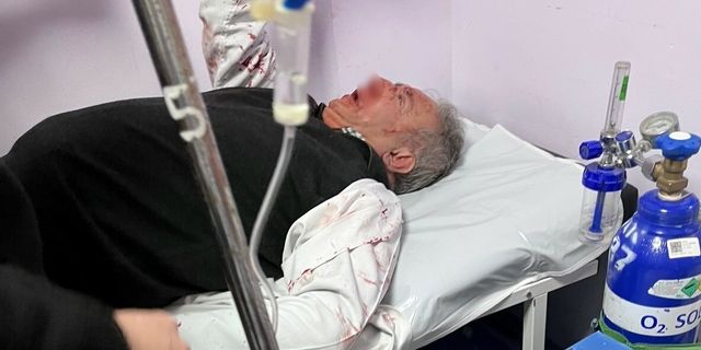 İstanbul'da saldırıya uğrayan aile hekimi yaralandı