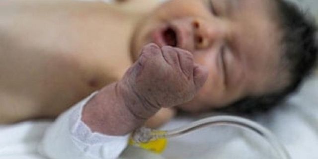 Binlerce kişinin evlat edinmek istediği ‘mucize bebek’ dayısına verilecek