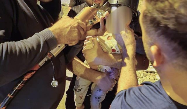 İskenderun'da kafası kovaya sıkışan çocuk kurtarıldı