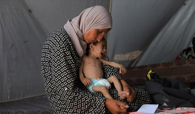 UNICEF: Haziran ayında Gazze’de 5800 çocuğa yetersiz beslenme teşhisi konuldu